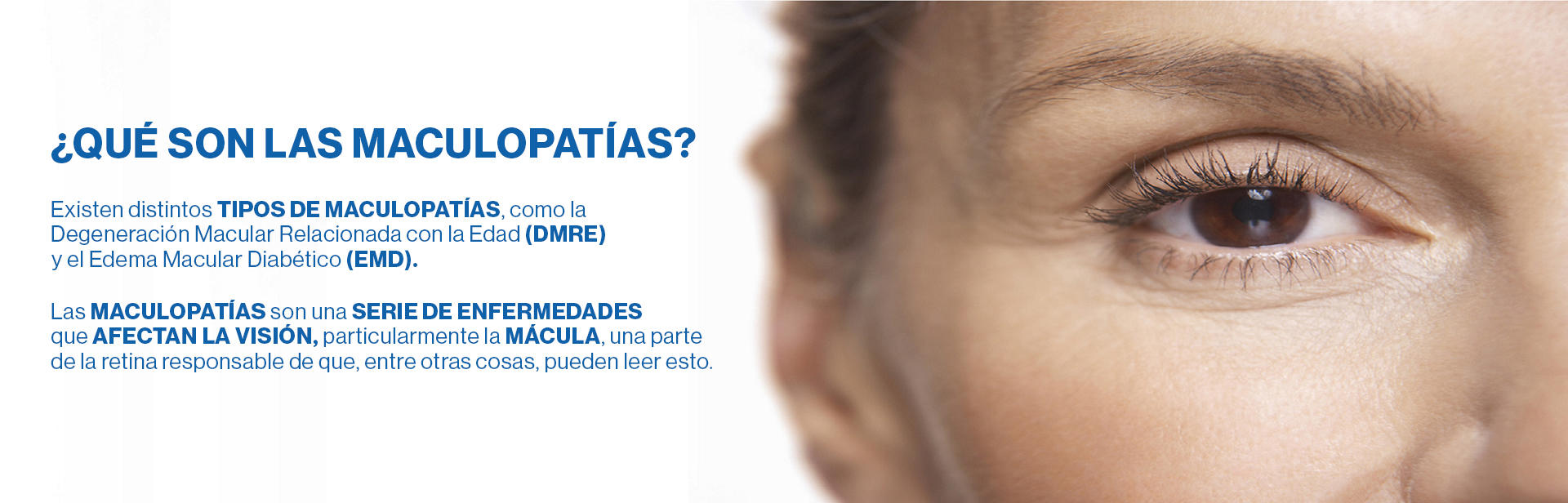que es