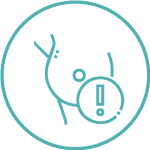 Las mamas densas tienen más tejido conectivo que tejido adiposo, lo cual dificulta la detección de tumores en la mamografía.4