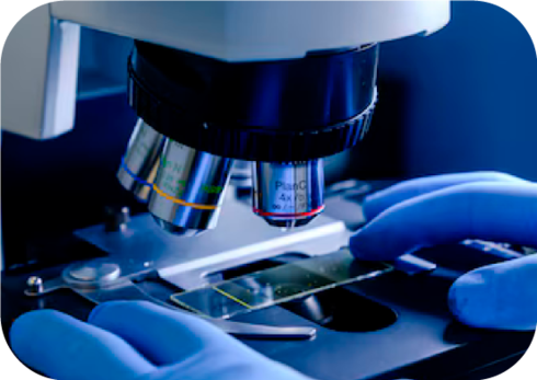 Cáncer de mama - Biopsia