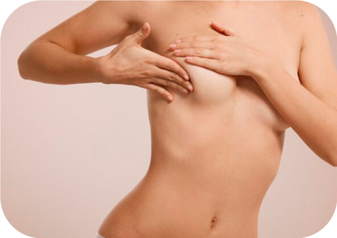 Cáncer de mama - Estadíos