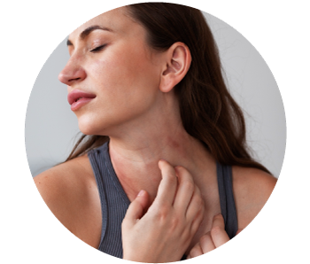 Imagen ilustrativa Picazón, ardor o dolor en las zonas.