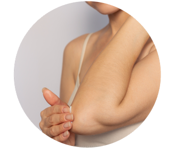 Imagen ilustrativa Sequedad de piel.