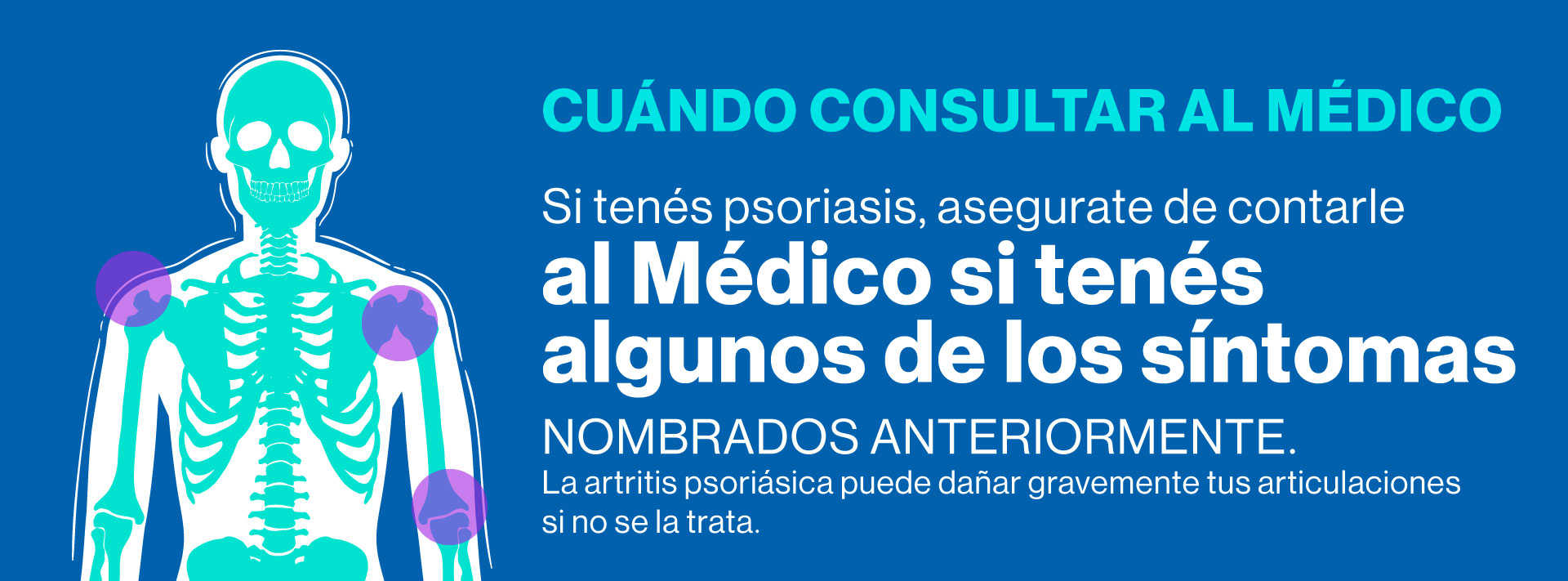 Si tenes psoriasis, asegurate de contarle al médico si tenes alguno de los síntomas nombrados anteriormente. La artritis psoriásica puede dañar gravemente tus articulaciones si no se la trata.
