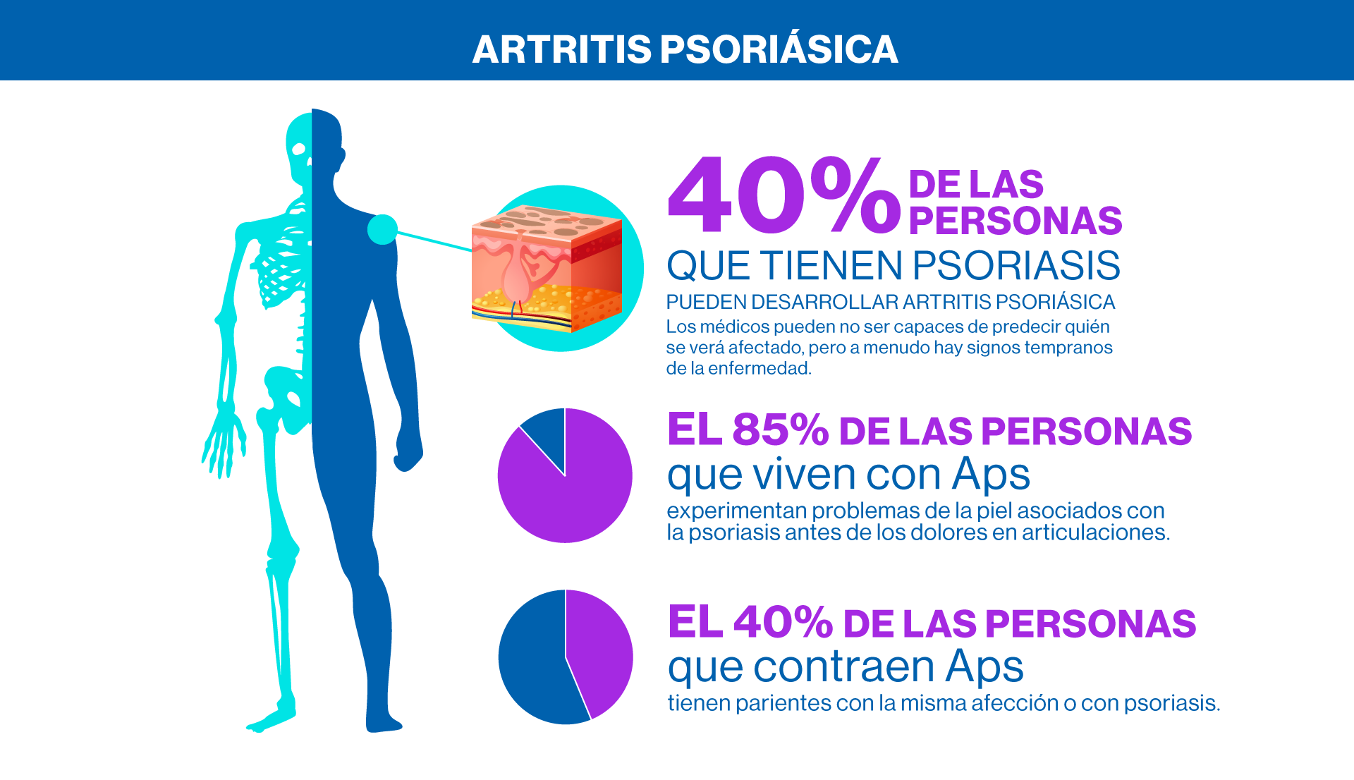 Artritis Psoriásica - Estadísticas personas con Artritis Psoriásica