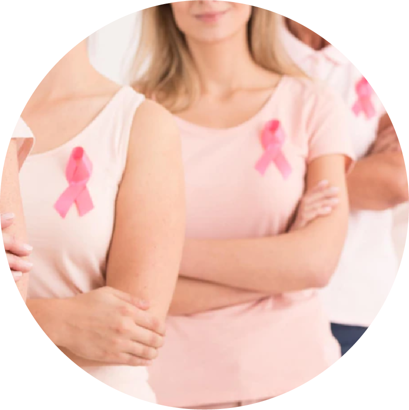 ¿Cómo sé si tengo un riesgo elevado de desarrollarcáncer de mama?