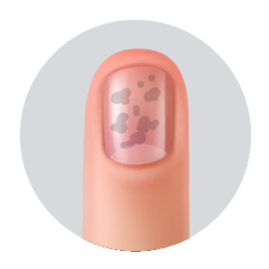 Ilustración matriz ungeal