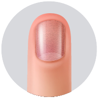 Traquioniquia (fuñas ásperas y con aspecto deslustrado por abundantes estrías longitudinales y depresiones puntiformes).