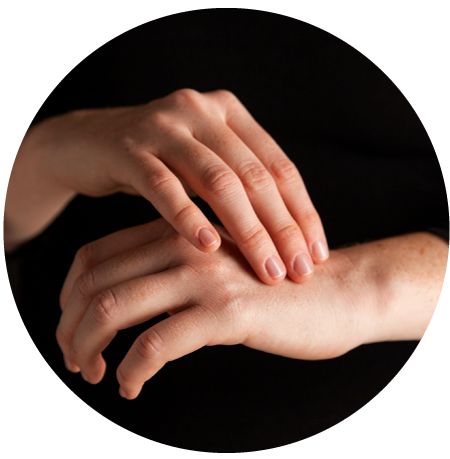 Imagen ilustrativa Psoriasis que es