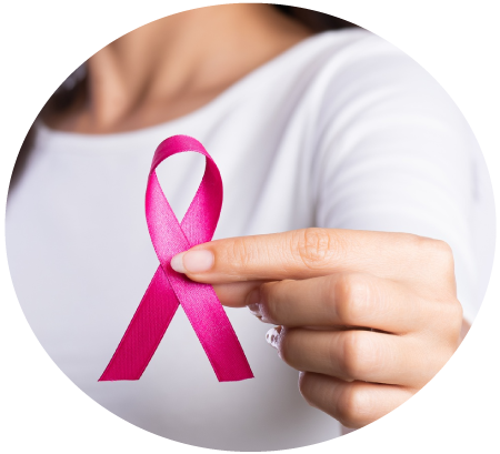 Imagen ilustrativa lazo rosa cáncer de mama
