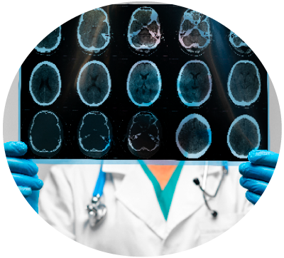 Imagen ilustrativa resonancia magnética para diagnóstico de Esclerosis Múltiple