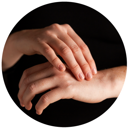 Imagen ilustrativa tratamiento topico