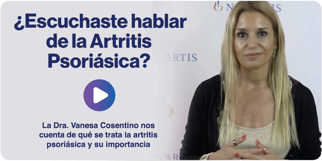 Imagen miniatura introducción al video de la Dra. Vanesa Cosentino, nos cuenta de qué se trata la artritis psoriásica y su importancia.