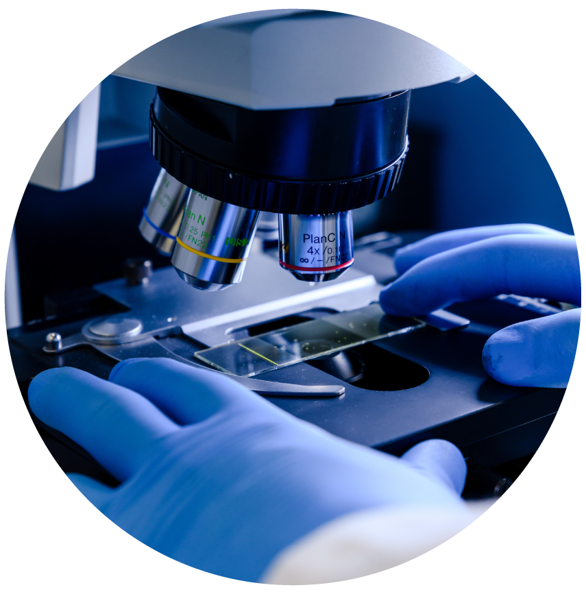 Glomerulopatía C3 - Cómo se diagnostica - Biopsia