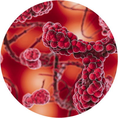Qué es la Glomerulopatía C3 