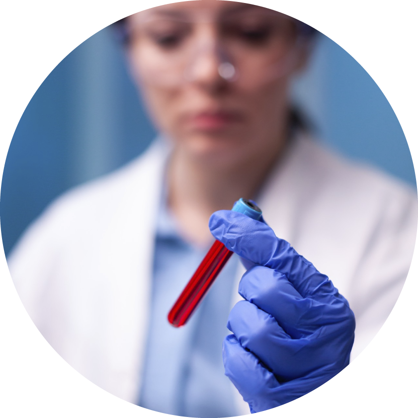 Tratamientos específicos de la glomerulopatía C3